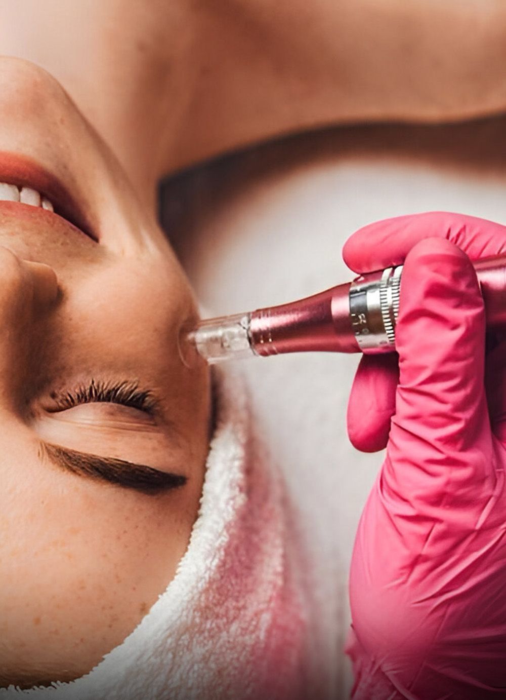 Micro Needling
